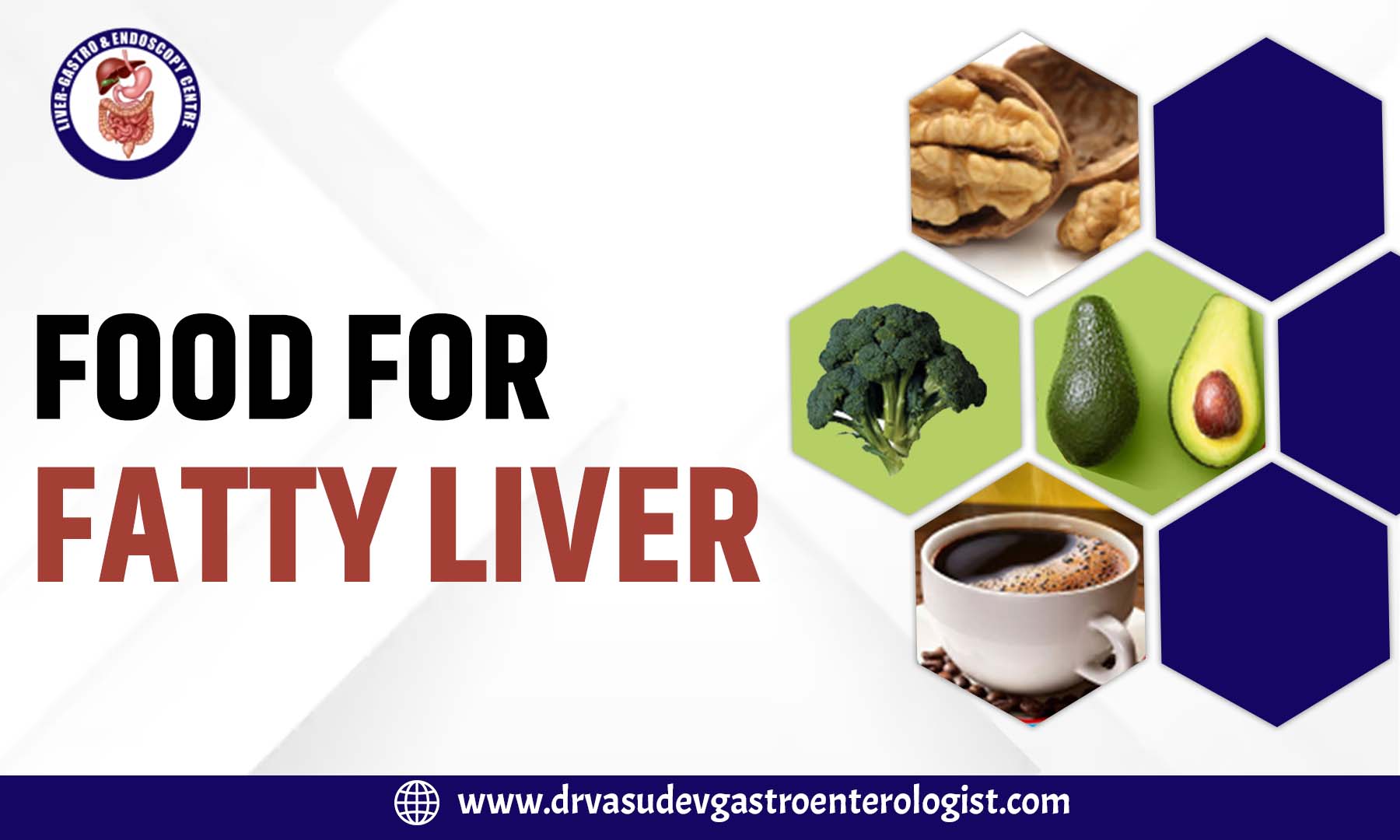 Fatty Liver Diet- Foods to eat and avoid