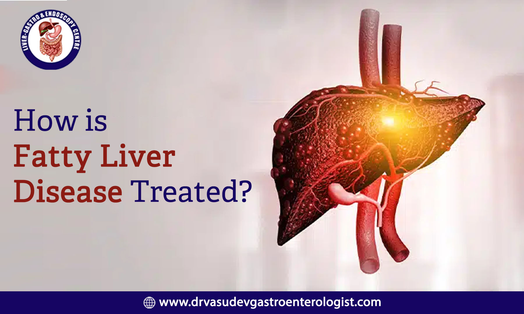 How Is Fatty Liver Disease Treated?