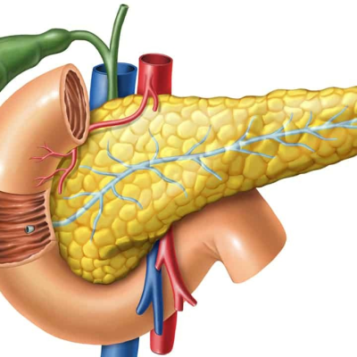 Pancreatitis